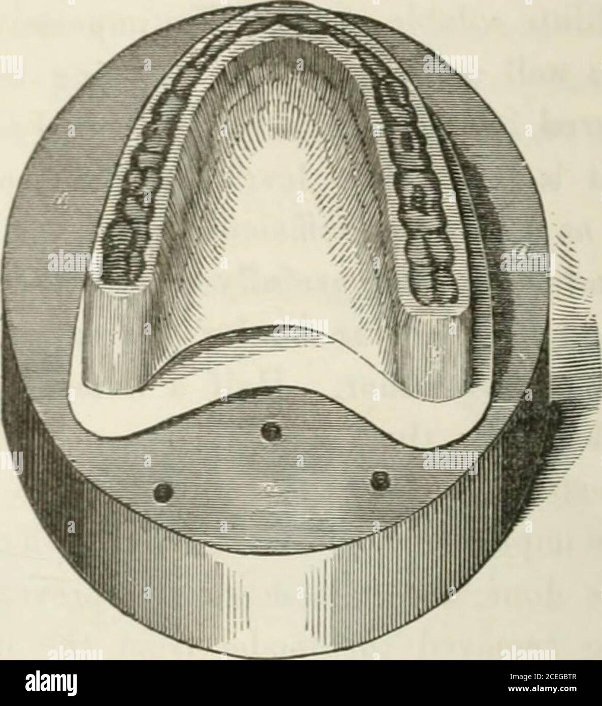 . Les principes et la pratique de la chirurgie dentaire. Ion, (voir Fig. 278, dans lequel l'artiste a représenté les trous en-tibase trop petit,) un revêtement de vernis est appliqué à chaque partie exceptque qui est à couvrir par la base pour les dents artificielles.cette partie est maintenant couverte d'une plaque de papier d'étain épais, rigidiépar l'application d'une feuille de cire molle à la pièce dans la recherche. Cela peut être un quart ou trois-quatre-quarts d'un pouce d'épaisseur, et quand il a durci, un bord de cire ramolli est placé allongthe bordure alvéolaire et taillé avec un couteau jusqu'à ce que sa largeur soit un peu plus grand que le TH Banque D'Images