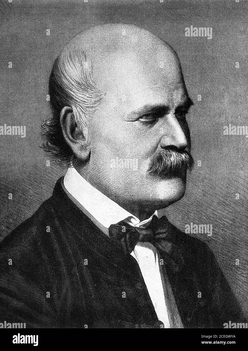 Ignaz Semmelweis. Portrait du médecin et scientifique hongrois, Ignaz Philipp Semmelweis (1818-1865), gravure par Jenő Doby, 1860 Banque D'Images