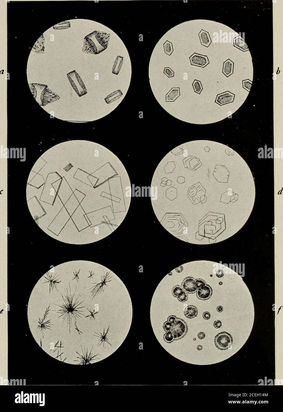 Tres Nombreux Cristaux D'oxalate De Calcium Dans Les Urines Calcium oxalate crystals Banque de photographies et d’images à haute