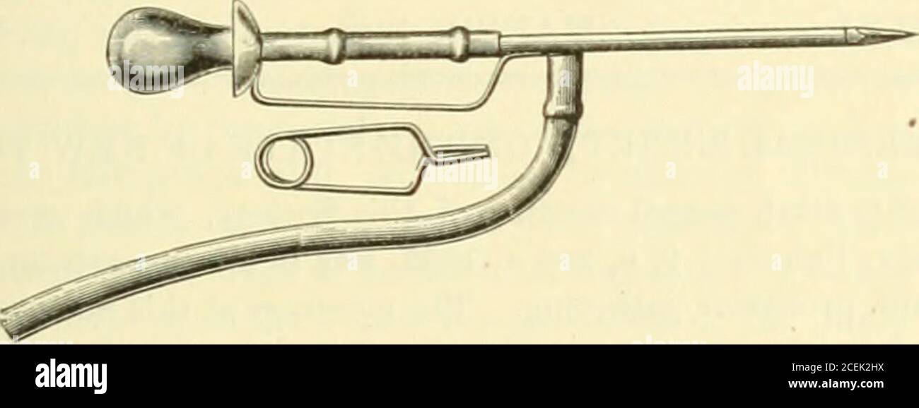 . Buffalo Medical Journal. al Nerve: Branche inférieure. 8, HypoglossalNerve. 9. Nerf accessoire. 10. Point Erbs (point supraventriculaire). 11. Nerf phrénique.12. Plexus brachial. 13. Nerf axillaire. MUSCLES. a. Frontalis, b. Onduleuse supercilii. c. Orbicularis palpebrarum, d. mus-cles nasaux, e. Muscles zygomatiques, F. Orbicularis oris. g. Massetor. h. Levater menti Quad-ratus mcnti (dépresseur labii inbioris). k. Myoidcs de Platysina. 1. Muscles hyoïdes.m Sterno-clcido-mastoïde. n. Omo-hyoïde. o. Splendicus. P. trapezius, r. Anguliscapull du levateur. 6. Triangularis menti (dépresseur anguli oris), t. S Banque D'Images