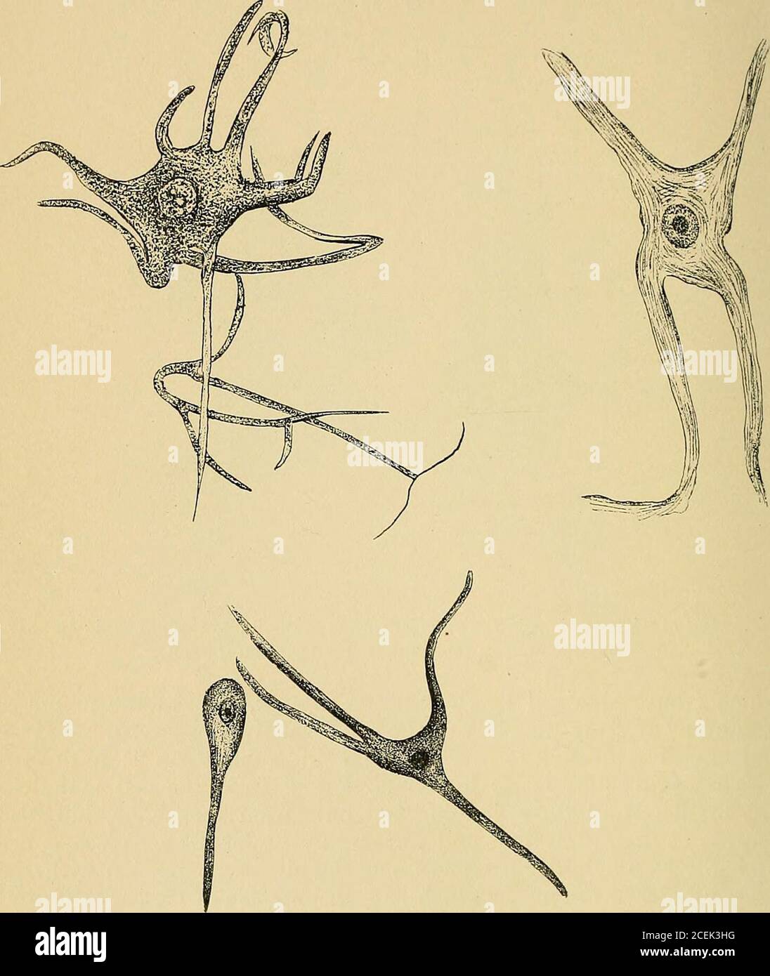 . Un traité sur les maladies nerveuses et mentales, pour les étudiants et les praticiens de la médecine. 8. Sur la Fig. 42 est vu un dessin d'une photo-micrographe, madefor moi par le Dr Henry McDonald, de ces mêmes cellules de corne antérieure observées sous le microscope, magnifiées 360 fois. Elle donne à aclear l'idée de leur position dans les mailles du tissu con-nectif, leurs processus se faisant dans différentes directions et surroutés par leurs espaces péricellulaires. Puisque nous sommes devenus dans une mesure au courant de la structurede la moelle épinière, nous verrons comment les fibres nerveuses fonctionnent de theanteri Banque D'Images