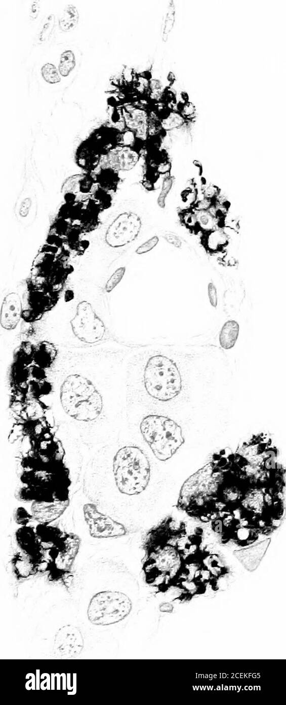 . Les perturbations pigmentaires, de croissance et endocriniennes induites dans le tadpole aunran par l'ablation précoce des pars buccalis de l'hypophyse. f^ £•/■<*- ^■ H^ W^^ #-- *^-, 0** %^ 39 k 0/ ly.i PLAQUE 12 EXPLICATION DES FIGURES 40 UNE petite portion de la surrénale d'un têtard de grenouille normal de 48/9.0. Régime du foie.fixé dans l'osmium-biehromate 195 jours après le stade opératoire. Babes safraninstain. Cortex noir, médulla et noyaux rouge. XV33. 41 UNE petite portion de la surrénale d'un tadpole de grenouille albino de 54/0.2. Même âge, régime, fixation et coloration que ci-dessus. X733. 136 TÔLE 12. Banque D'Images