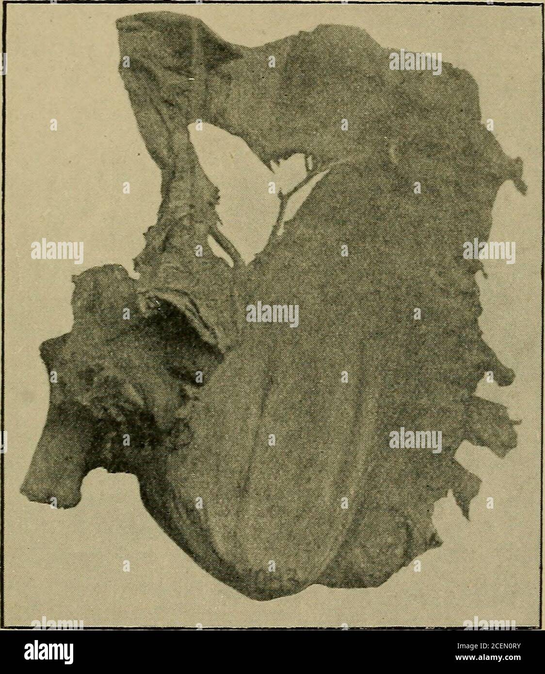 . Sur la hernie rétro-péritonéale : être les conférences 'Arris et Gale' sur 'l'anatomie et la chirurgie du fosse péritonéale' : livré au Collège royal des chirurgiens d'Angleterre en 1897. II.—COLLÈGE ROYAL DES CHIRURGIENS. 168 DESCRIPTION DE LA PLAQUE III III.SPÉCIMEN 1083. MUSÉE DE L'HÔPITAL GUYS. Hernie duodénale gauche. La flexion splénique et la partie descendante d'un côlon dans l'angle entre lequel est situé un péritonéal globulaire saceral mesurant environ 4 pouces de diamètre, et contenant les pieds de securse de l'intestin grêle. La bouche du sac est dirigée vers la colonne vertébrale et le long de son m antérieur Banque D'Images