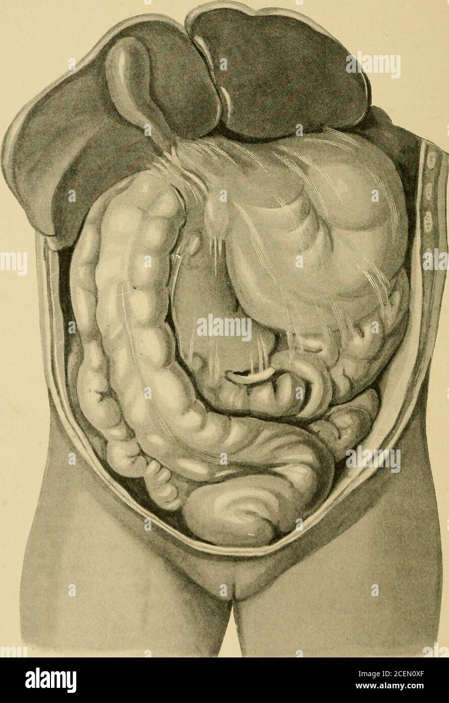 peritoneal membrane banque d image et photos alamy