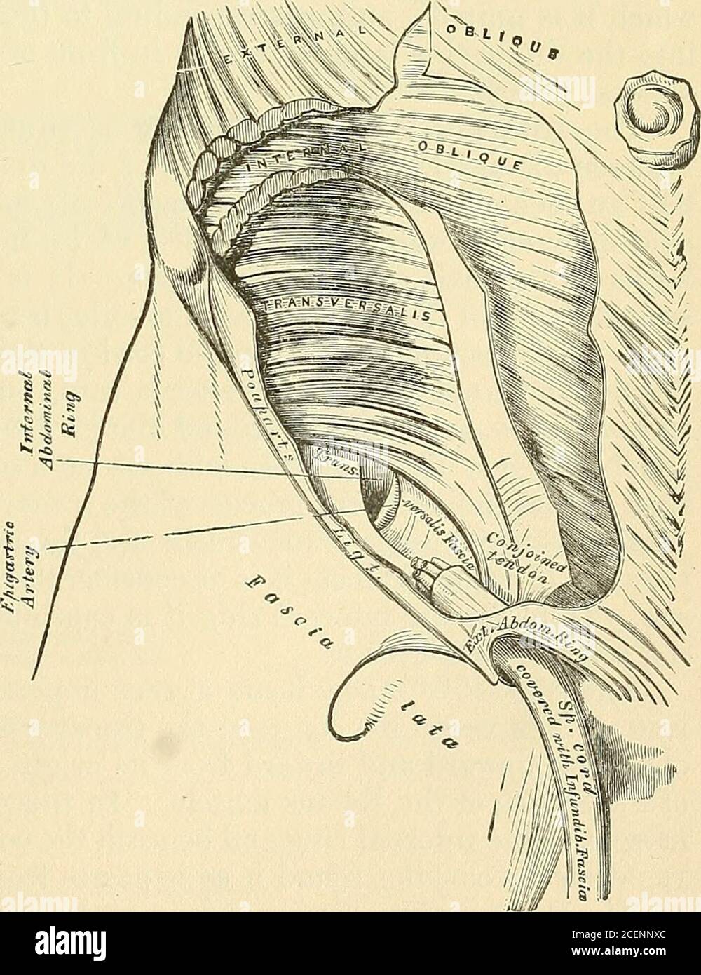 . Anatomie, descriptive et chirurgicale. ique hernie in-guinale, qui prend le samecourse comme cordon spermatique, le muscle Cremaster forme un de ses couches. Ce muscle becomeslargement développé dans le cas de l'hydro-cele et de la grande ancienne hernie scrotale.aucun tel muscle existe dans la femelle, mais une structure analogue est devel-oped dans les cas où une hernie obliqueinguinale descend bienatla marge de l'oblique interne. L'oblique interne doit être déteaché du ligament Pouparts, classé sepa des Transversalis jusqu'au sameextent comme dans les incisions précédentes, et réfléchi vers l'intérieur sur les s. Banque D'Images