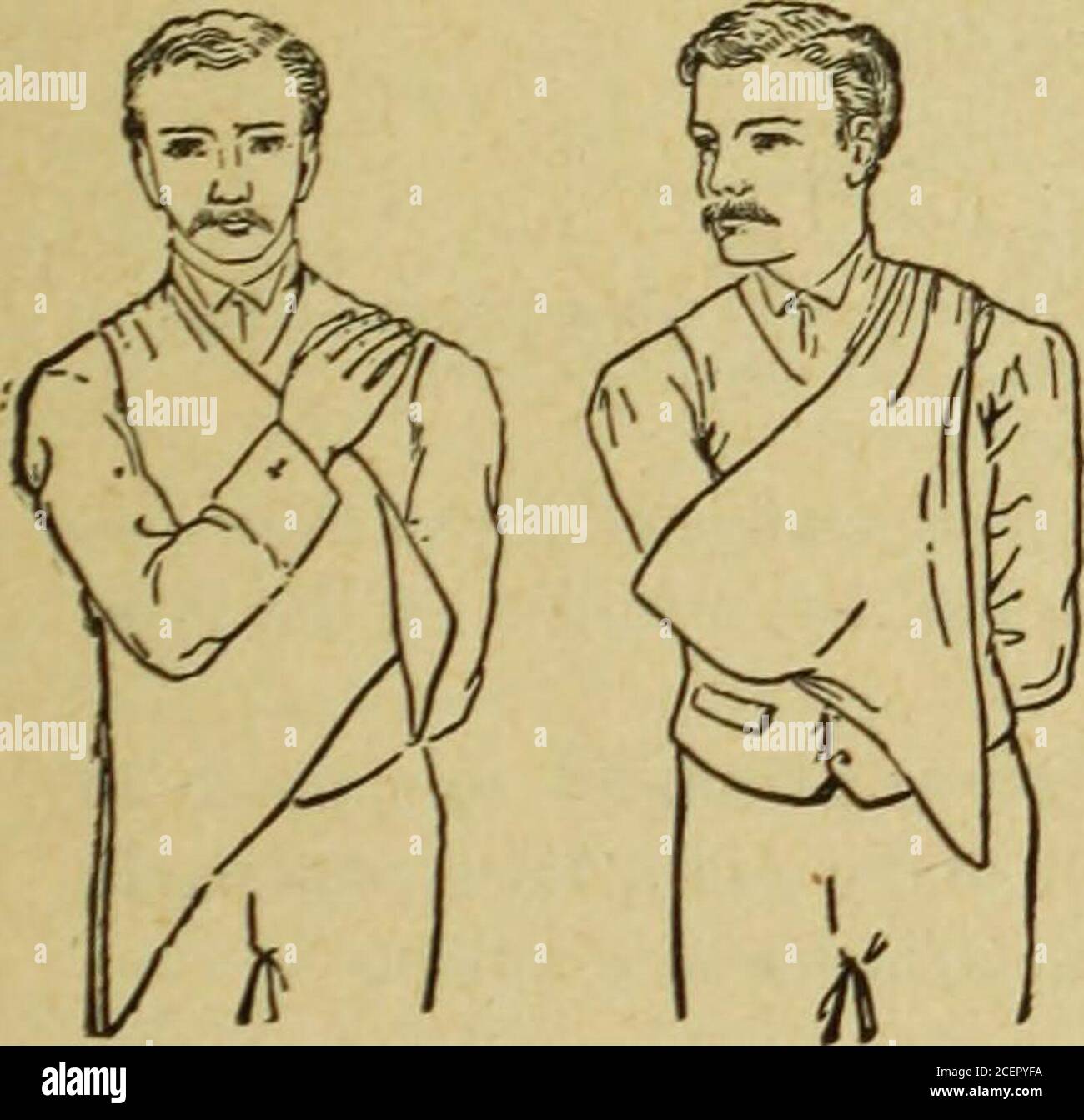 . Médecine moderne et revue bactériologique. Figure 31.—bandage à nombreuses queues. ?qui quelques dix-huit ImbricatedStrips plus courts (Fig. 31) sont cousus à des nœuds droits. Le membre est posé sur le bandageso que son axe correspond à la bande cen-tral et, à partir de la périph-ery, les bandes sont doucement et firmlyrepliées comme indiqué sur le schéma. APIN de chaque côté, fixant les deux laststrips à leurs prédécesseurs, sert tofasten tout en toute sécurité. En sortant les broches,. A b Figs. 32 et 33.—le mouchoir triangulaire soutient le coude, a et b. et tire les queues vers la droite et la gauche, l'ensemble du banda Banque D'Images