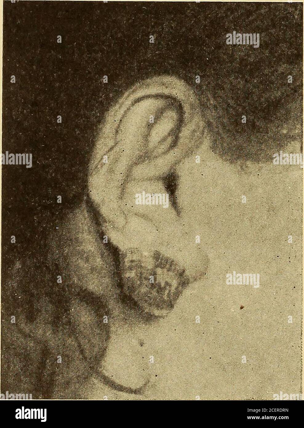 Maladies de l'oreille; un livre de texte pour les praticiens et les  étudiants en médecine. e membres supérieurs et inférieurs de l'incision aux  points d'entrée et de sortie de l'écoulement du