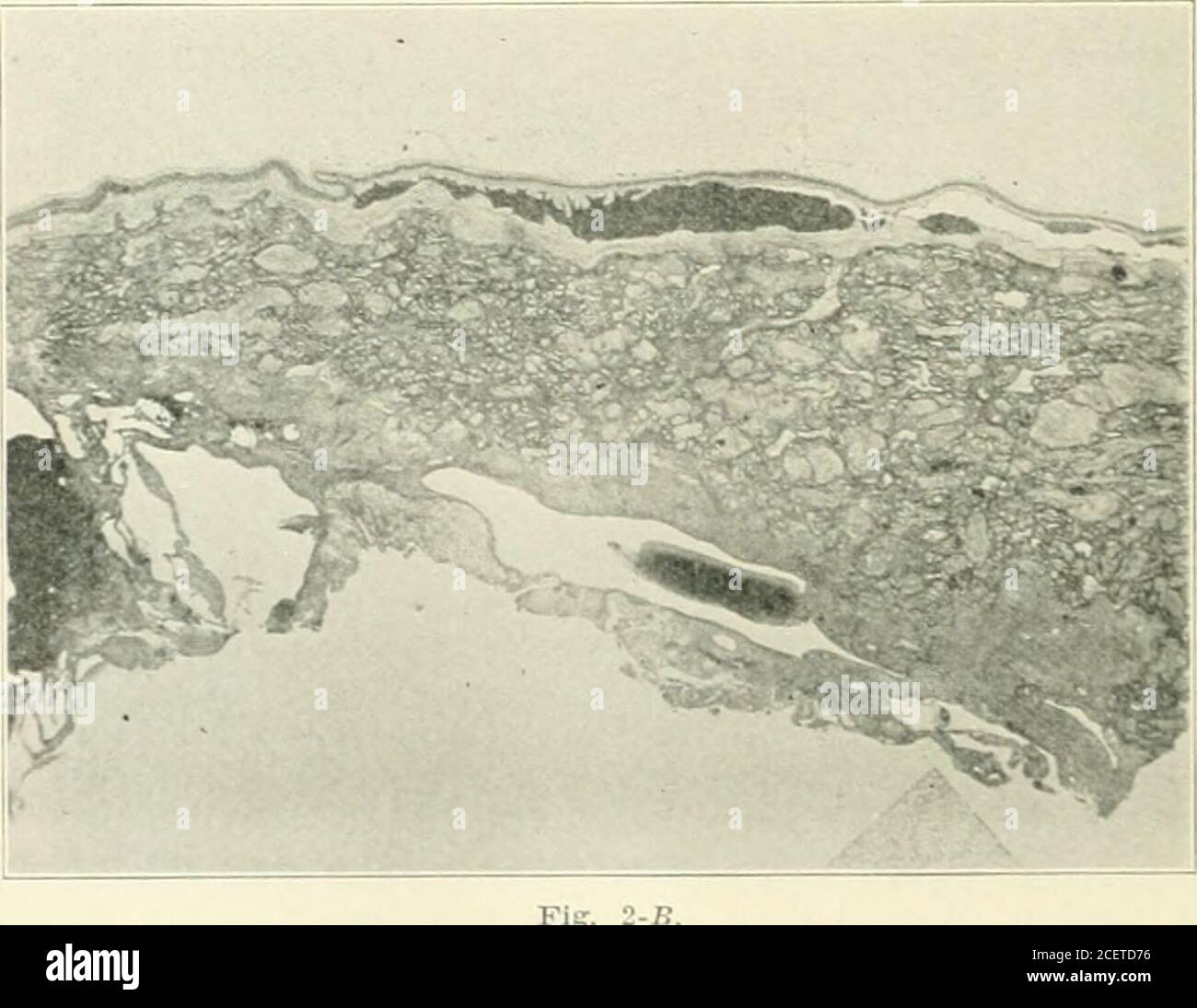 Fœtus Jumeau Banque D Image Et Photos Alamy