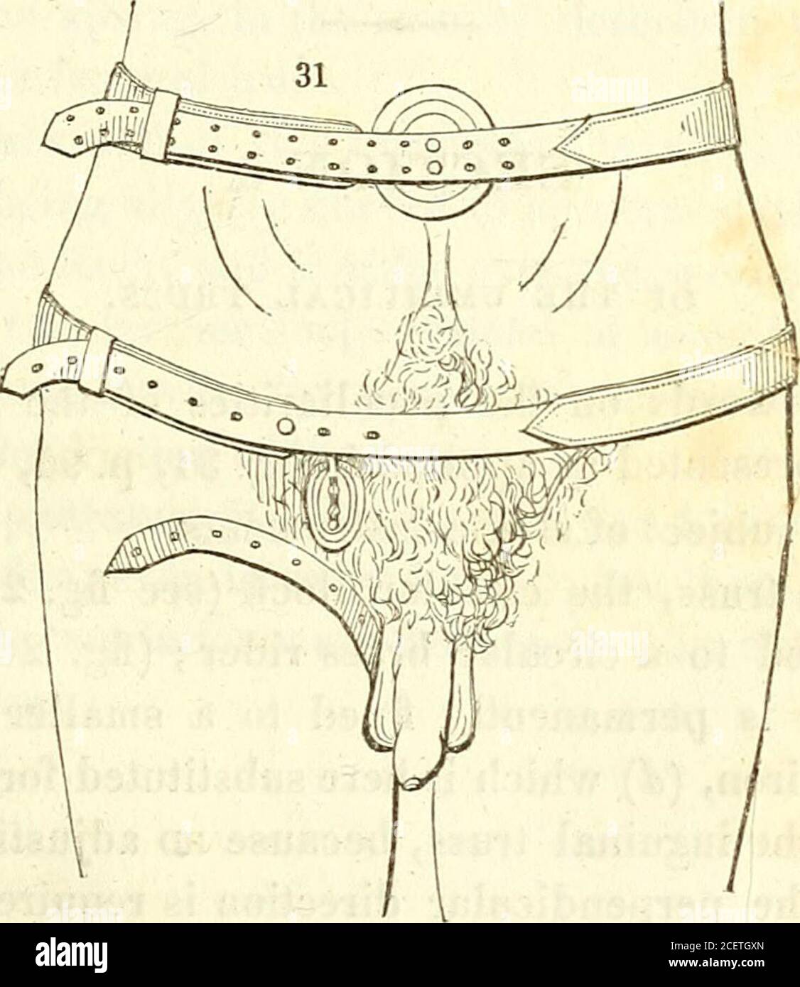 . Traité sur la guérison radicale de la hernie par des instruments : englobant une analyse des propriétés mécaniques des diverses fermes actuellement utilisées, une description des nouveaux instruments inventés par l'auteur, et des directions générales aux patients pour l'emploi sûr de ces instruments, avec des conseils aux chirurgiens dans leur application, etc. ^ un long col en fer,{gl) au lieu du court vu dans le dernier instruit ; et ceci, au lieu d'être soudé au ressort, s'étend le long de la fenêtre ou de la fente, (k) où il s'agit DE LA STRUCTURE FÉMORALE. 93 relié au ressort par les deux vis de réglage (m m), pré Banque D'Images