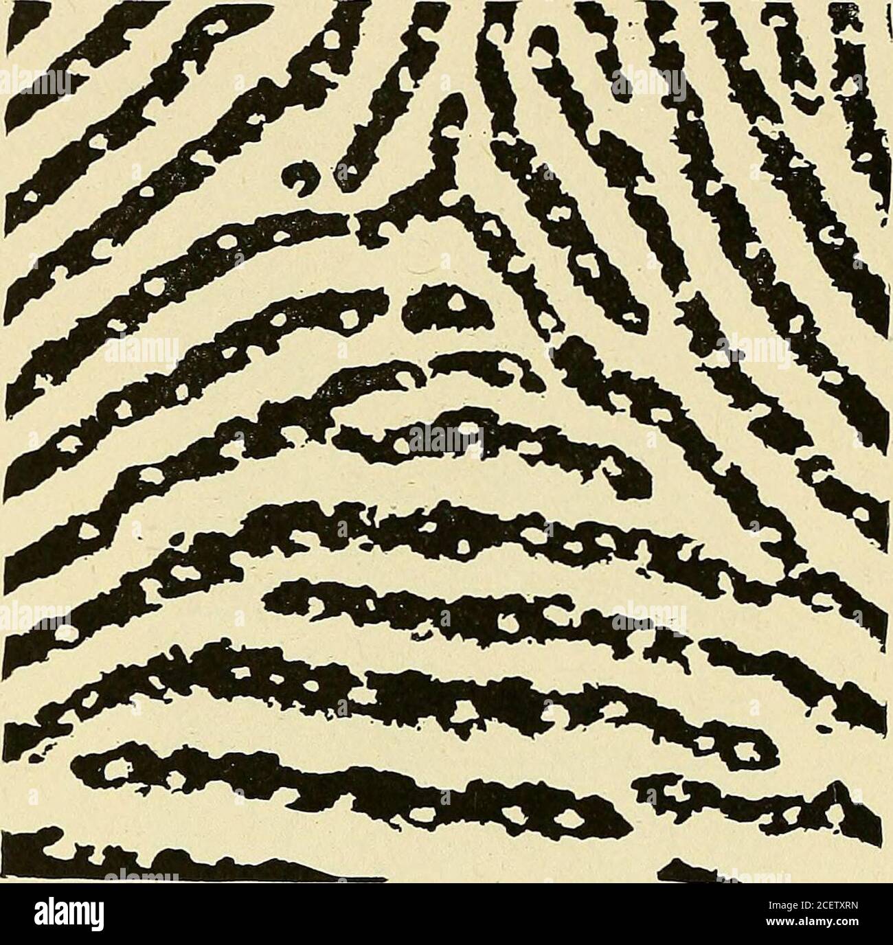 . Identification personnelle; méthodes d'identification des individus, vivants ou morts. 6 et 117 du chapitre précédent. La zone en-fermée dans le carré est illustrée à la figure 139 avec un agrandissement de 11 diamètres. La ligne utilisée dans takingthe Ridge count est également donnée, et montre un décompte de 1.5. Homme ordinaire ou pratique spécifié par notre critique, et pourtant il est forhim (et le critique) que cette analyse est particulièrement écrit. À la taille naturelle, tout comme ils ont été pris, il doit être reconnaésque ces deux tirages ont l'air très semblables, mais montré à la slightgrossissement de 4 diamètres (Figures Banque D'Images