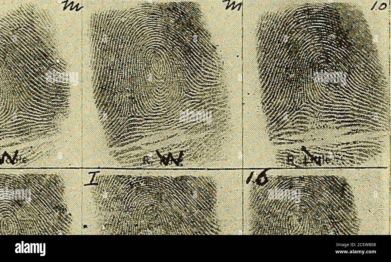 . Identification personnelle; méthodes d'identification des individus, vivants ou morts. i-^M^^ .^JSF^^k^ 1. l/frle Figure 84. Carte d'identification de 6 x 6 pouces, utilisée par les auteurs. Les empreintes digitales sont entièrement sur le devant, avec les photographies et les mesures de Bertillon. Au verso se trouvent le nom, les alias et autres données, les marques corporelles et les antécédents criminels. Les impressions simples (quatre doigts ensemble, non enroulées) sont omises. L'illustration ci-dessus a réduit J^. Le système vertical de classement est sans aucun doute la meilleure méthode et la méthode de la fraude. Pour ce faire, les tiroirs doivent avoir une dim intérieure Banque D'Images