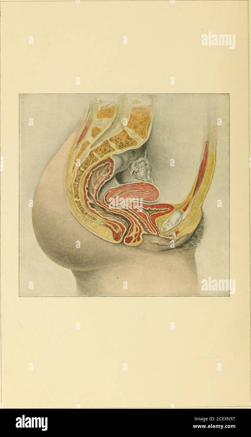 . Un livre de texte américain d'obstétrique. Pour les praticiens et les étudiants. Section mésiale montrant la relation des viscères dans leurs positions normales (Dickinson). {pour plus de détails, voir Fig. J, p. 42.) UN LIVRE DE TEXTES AMÉRICAINS D'OBSTÉTRIQUE POUR LES PRATICIENS ET LES ÉTUDIANTS PAR James C. Cameron, M.D., Edward P. Davis, M.D.Robert L. Dickinson, M.D., Charles WarringtonEarle, M.D., James H. Etheridge, M.D., Henry J.Garrigues, M.D.. Barton Cooke Hirst, M.D.Charles Jewett, M.D.. Howard A. Kelly, M.D.Richard C. Norris, M.D.. Chauncey D. Palmer, M.D.Theophilus Parvin, M.D., George A. Piersol, M.D.Edward Reynolds, Banque D'Images