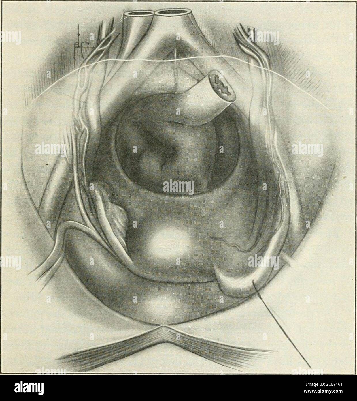 Ligament inguinal Banque de photographies et d’images à haute