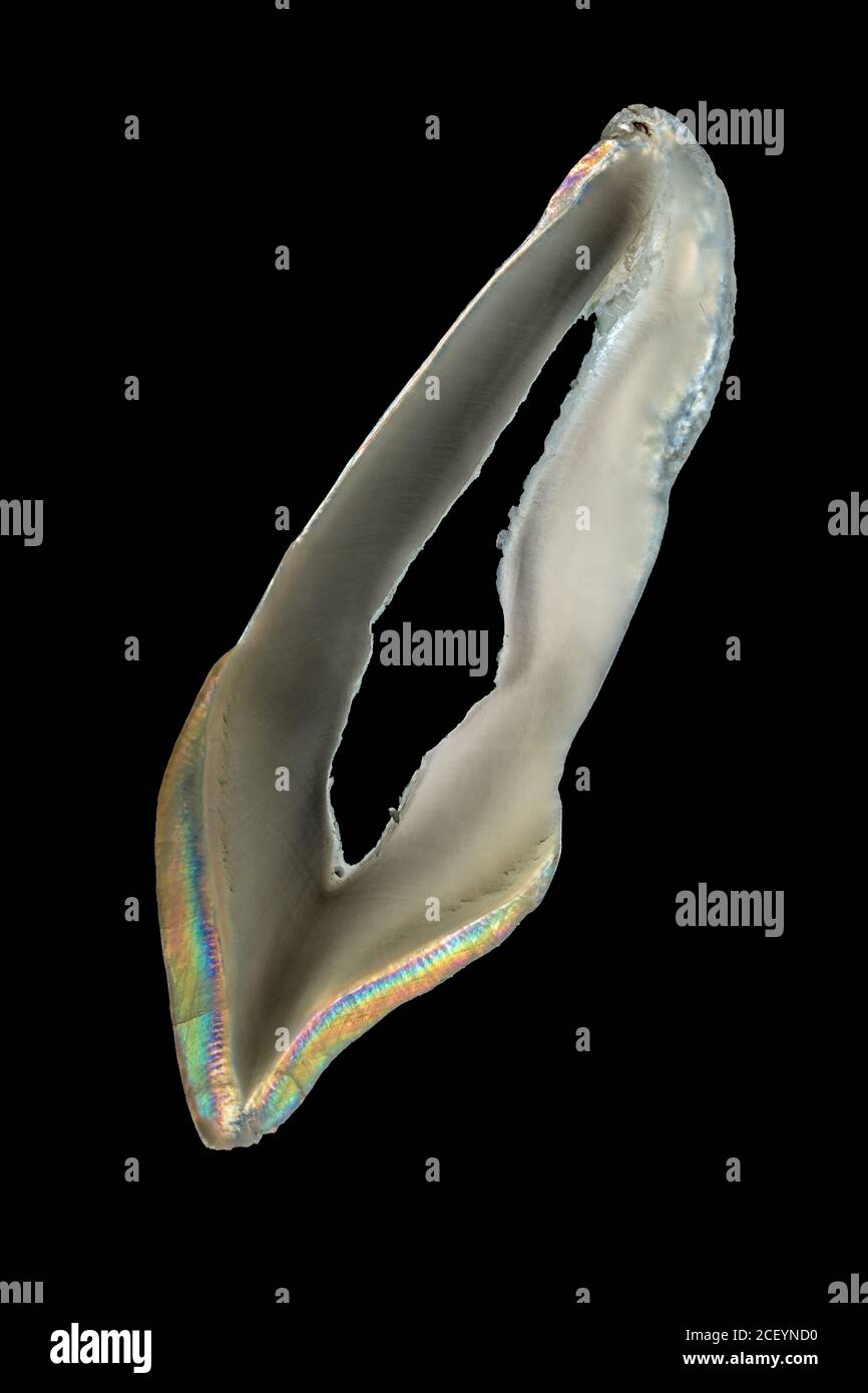 Macro-photographie de polarisation croisée des dents Banque D'Images