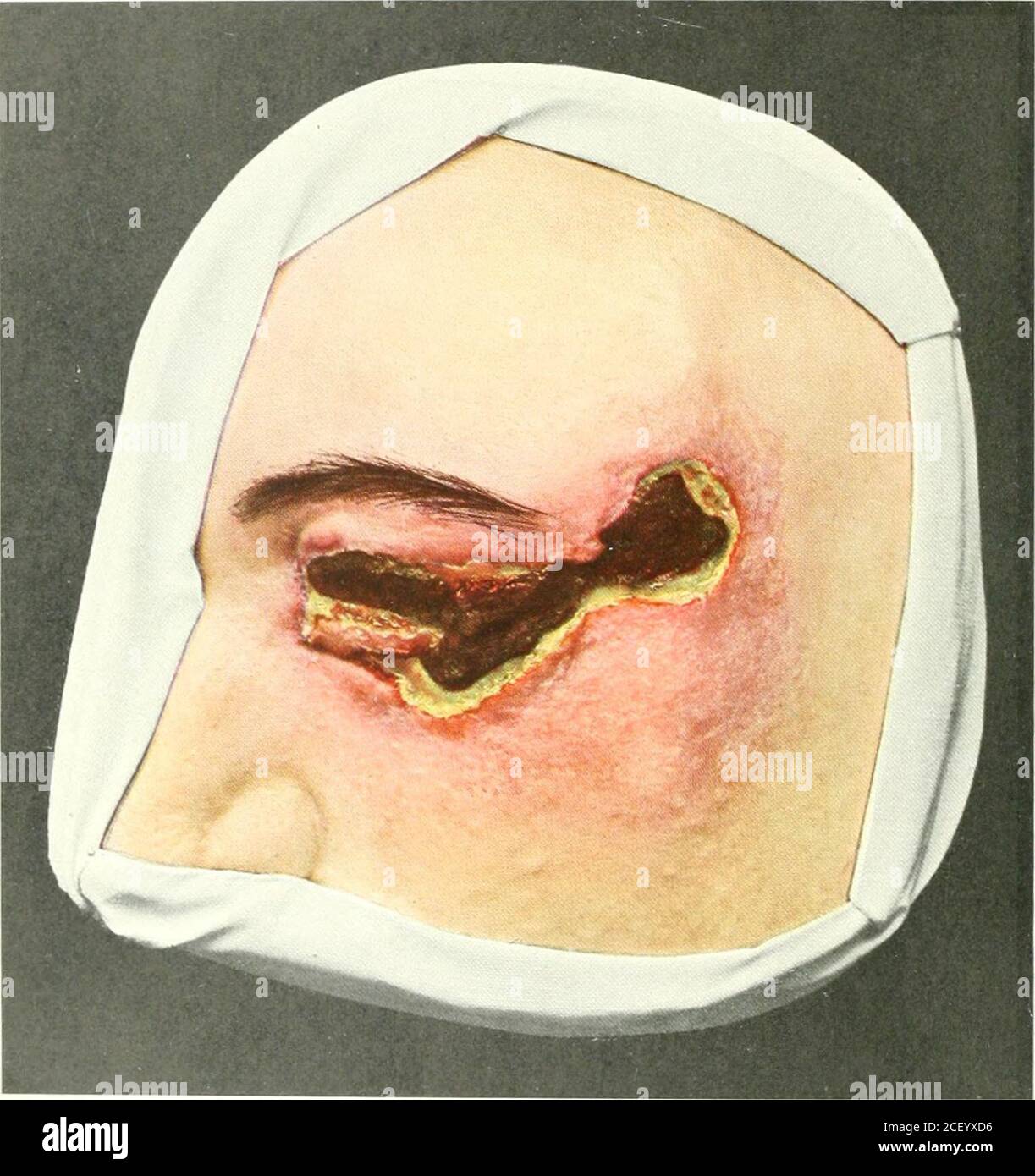 Atanner . Atlas de la chirurgie clinique; avec une référence spéciale au ...