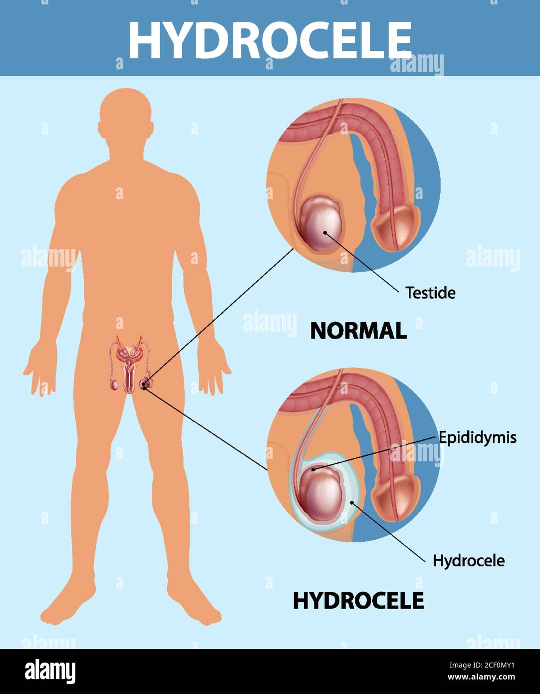 Testicule homme Banque de photographies et d'images à haute résolution -  Alamy