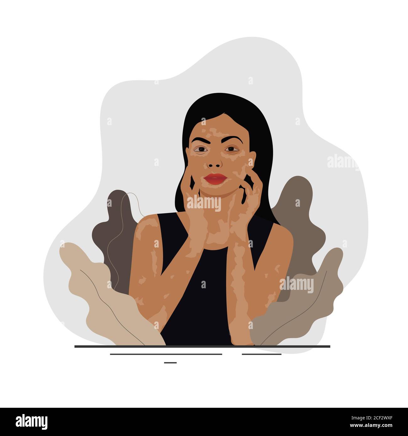 Femme avec taches de vitiligo blanc pâle. En tenant la main sur son visage. Les normes de beauté, la santé, les conditions de peau, la dermatologie et les maladies immunitaires. Banque D'Images
