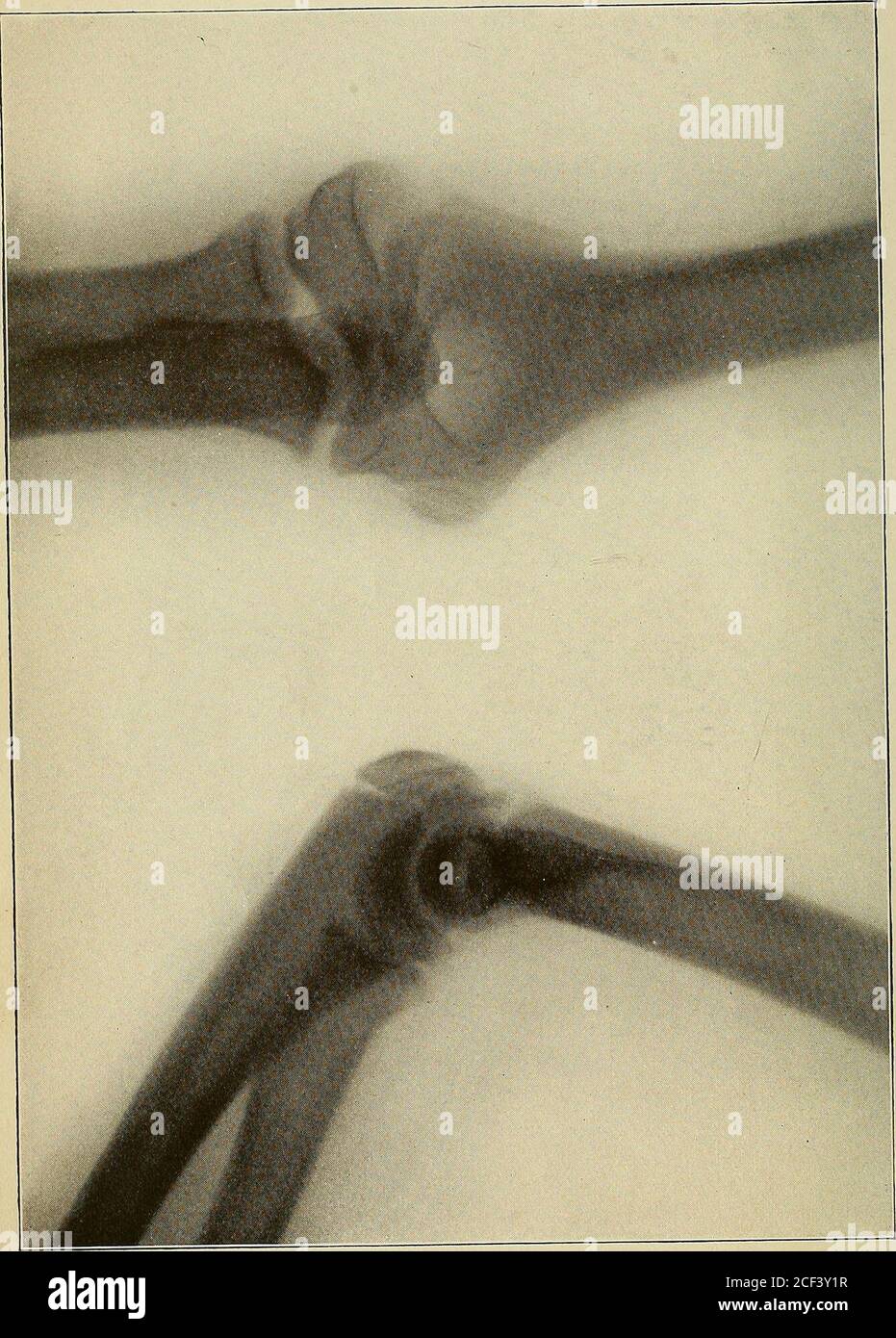 Condyle interne Banque de photographies et d’images à haute résolution ...