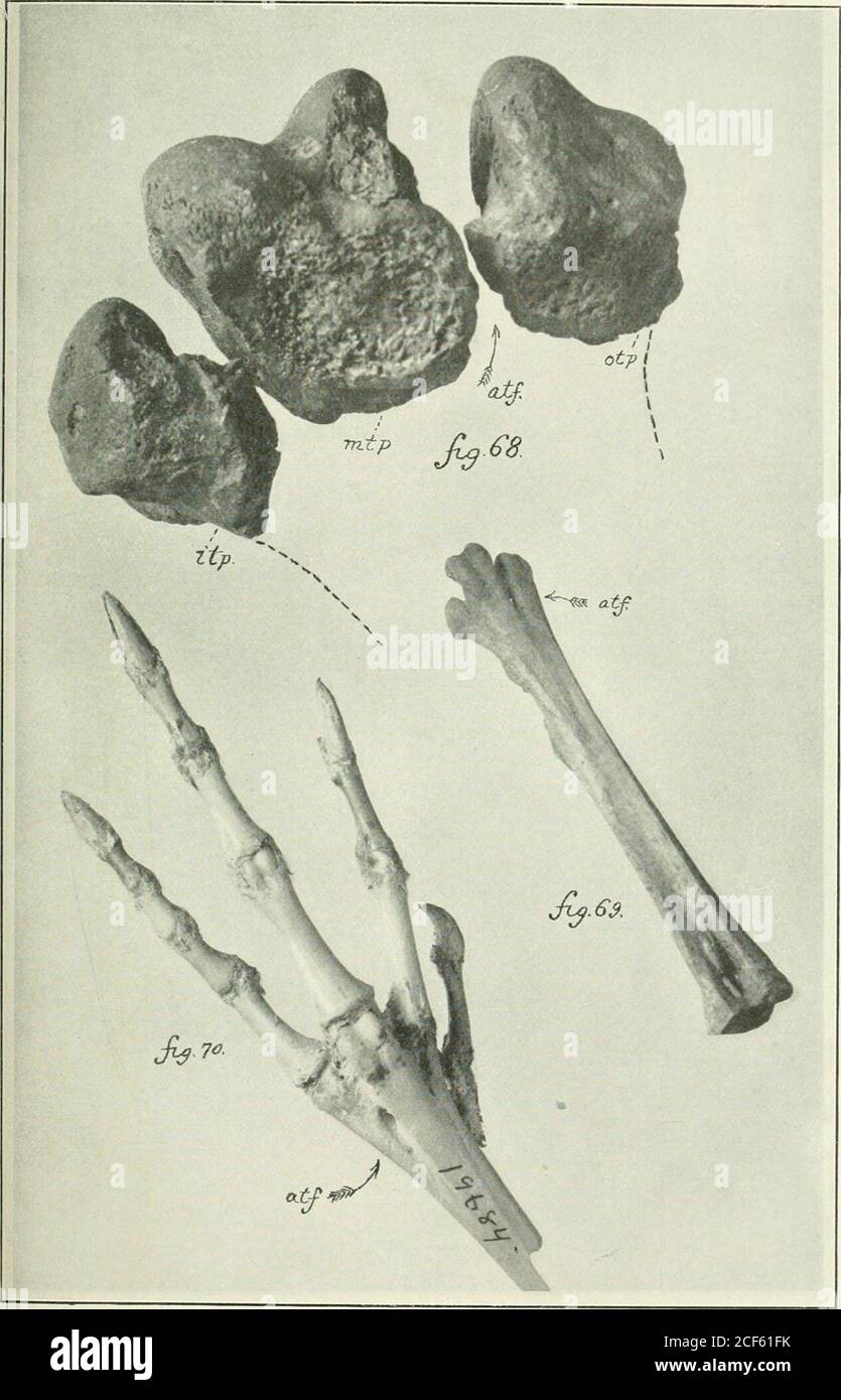 . Métatarse de Diatryma giganle, arrangé in situ, ou disposé dans la position correspondante à ceux du boneshown dans la figure 69, vers le haut, processus de Trochlear interne. (Il s'agit de l'échantillon ]Iarsh.)(planche II, figure 16, et planche V, figure 30); mlp, procédé de la moyenne trochlear; procédé de la partie extérieure trochlear. Les deux dernières sont les tjpes de la collection de Theu. MUSÉE national DE S., atf, foramen tibial antérieur. Figure 69. tarso-métatarse droit d'une volaille domestique commune (CT. Ad.), aspect antérieur. Collection d'auteurs, atf, foramen tibial antérieur. Ceci permet de bonheshare la taille relative entre Banque D'Images