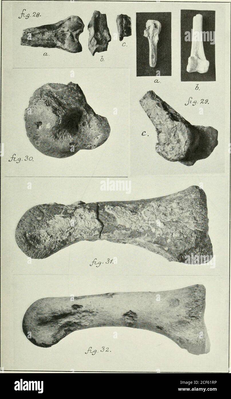 . Transactions. (Voir description.) c, portion distale du fémur droit de certains grands oiseaux verj, vue sur une vue antéro-oblique. (Pas de données extraites ; voir la description.) Cat N° 863, Yale Rec. Fig. 30. Vue extemo-latérale directe du processus intérieur de la trochlear du tarso-métatarse du Diatryma gigantea. Il s'agit du spécimen prélevé par Marsh. Dans la figure, la fracture est au-dessus de. (Voir également la plaque II, schéma 16.) Taille NAT. Figure 31. Articulation phalangienne de la pédale de Diatryma aja.x Shuf. (Basal de l'orteil moyen-antérieur ?.) Taille NAT., aspect latéral. (TJ-pe.) (Figure 13, plaque LIV, Amer. Cible MUS. NAT. H Banque D'Images