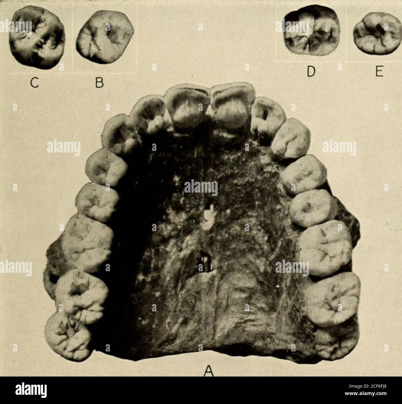 Guide Via 17 Fossile Humain Inferieur Lws Du Hack Neandertal A Lemoustier H Ehringsdorf Enfant Photographies Du Professeur J Ii Mc Lrenr Salle De L Age De L Homme 27 Figure 18 Patrimoine Anthropoide A