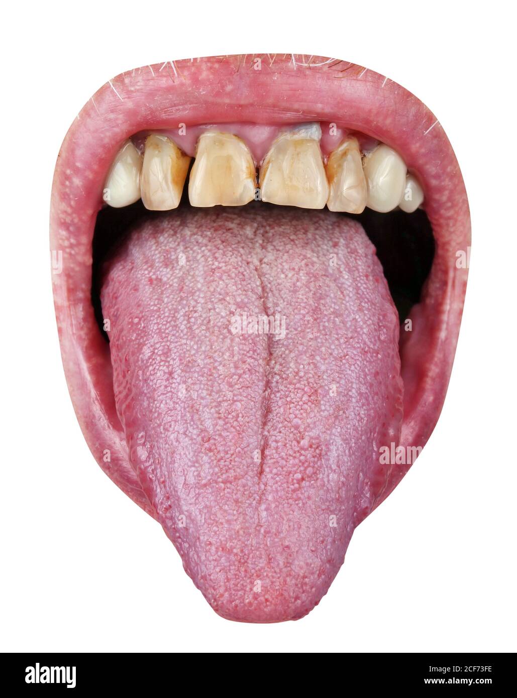 Les dents jaunes abd rouge langue macro. Isolé sur blanc Banque D'Images