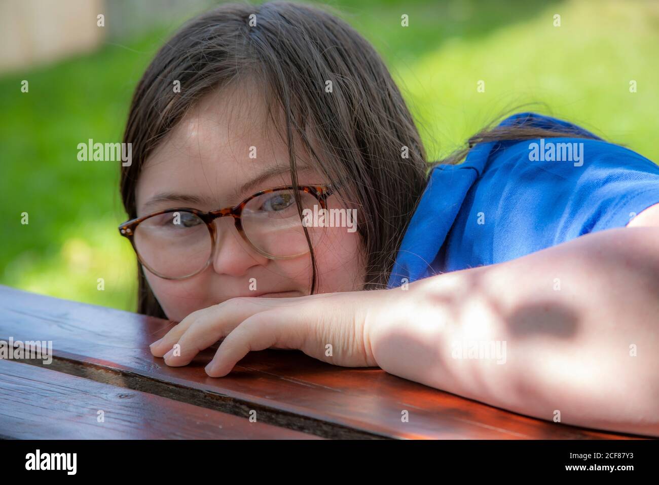 Jeune fille atteinte du syndrome de Downs lors d'une journée au zoo de Hamerton, dans le Huntingdonshire. Banque D'Images