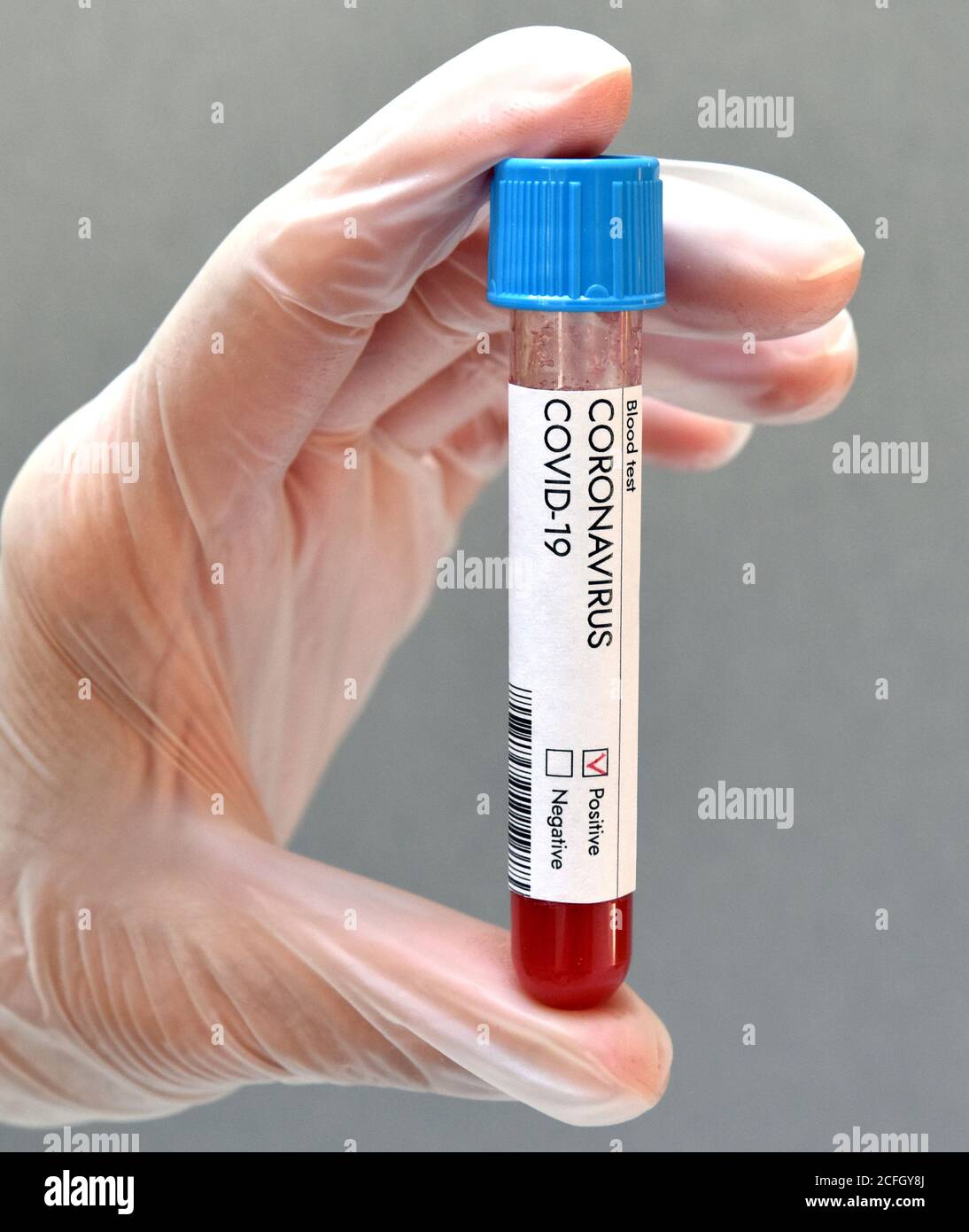 Test du coronavirus résultat positif de l'échantillon de sang sur fond blanc. Vaccin contre le coronavirus. Banque D'Images