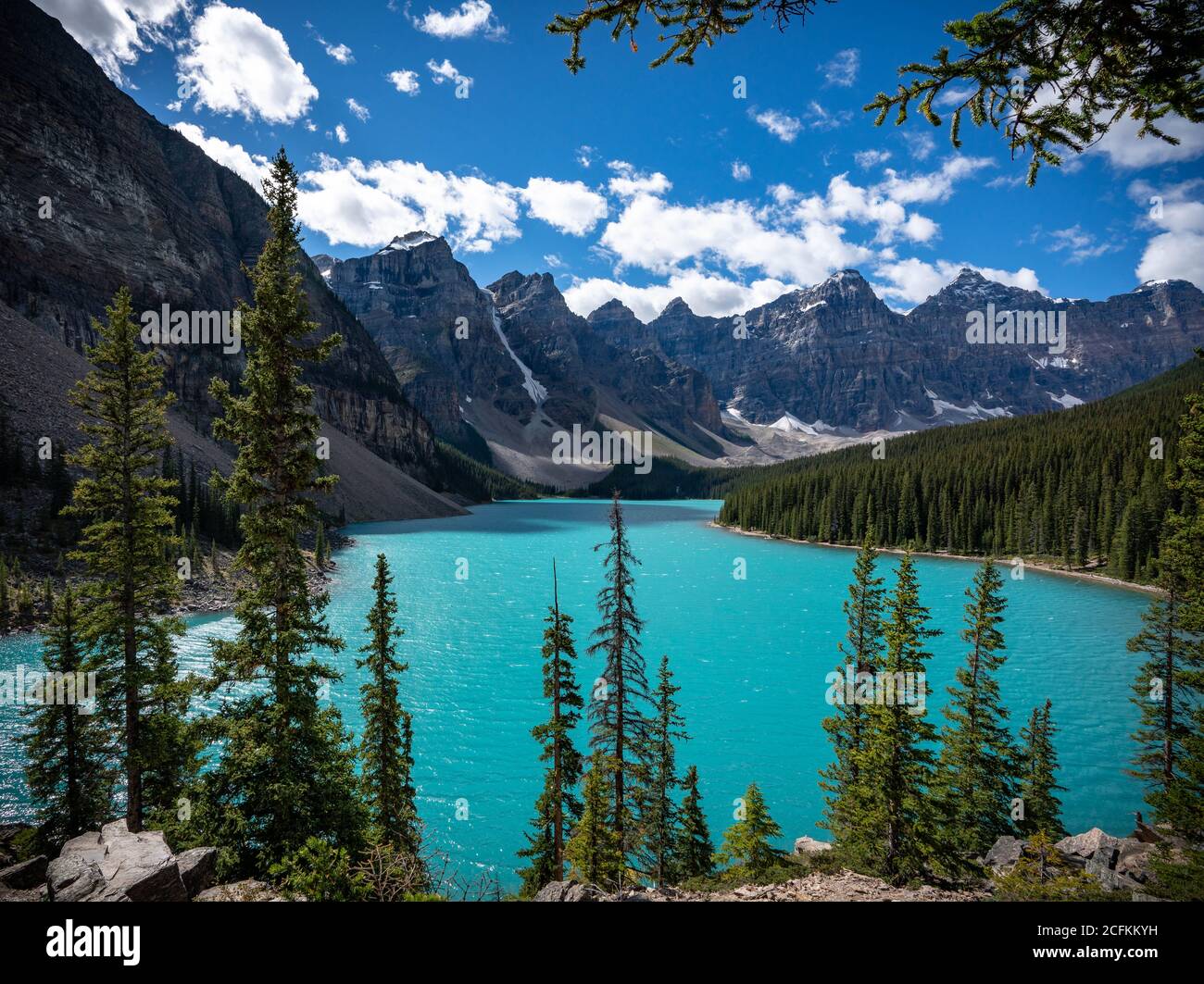 Lac Moraine avec ciel bleu ensoleillé en milieu de journée. Banque D'Images