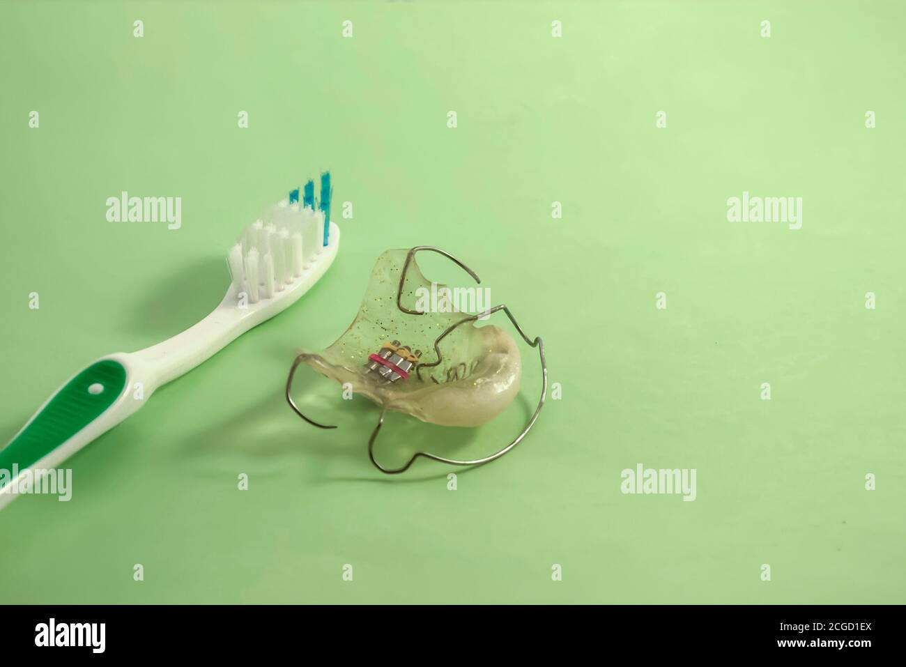 Boucle Orthodontique Préformée Pour Bande Molaire - Maintien D'espace Dentaire, Métal, 1ère/2e Molaire