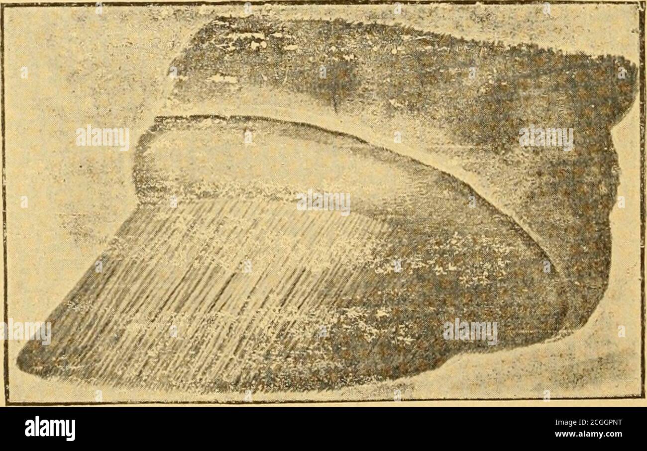 semelle pour pied sensible