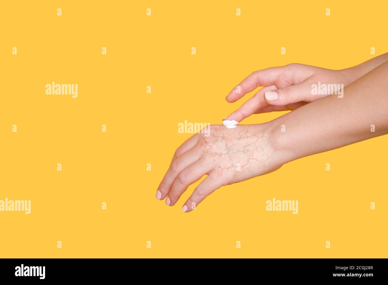 Soins des mains, peau douce. Mains avec peau sèche et hydratant. Espace  libre pour le texte Photo Stock - Alamy