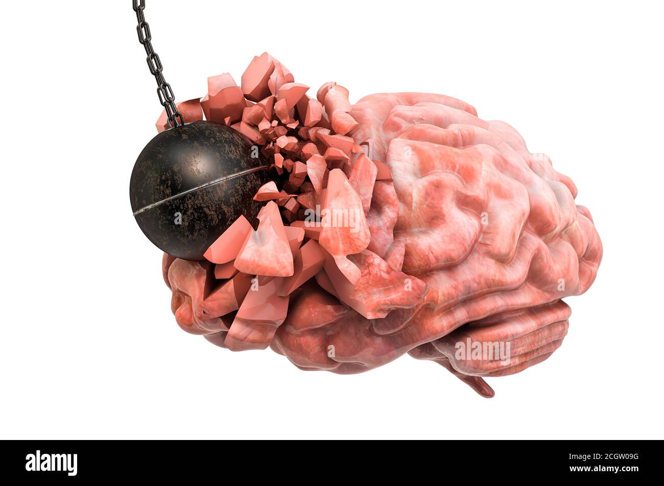 Destruction du cerveau en détruisant le ballon. Douleur à la tête, concept de maladie du cerveau. Rendu 3D isolé sur fond blanc Banque D'Images