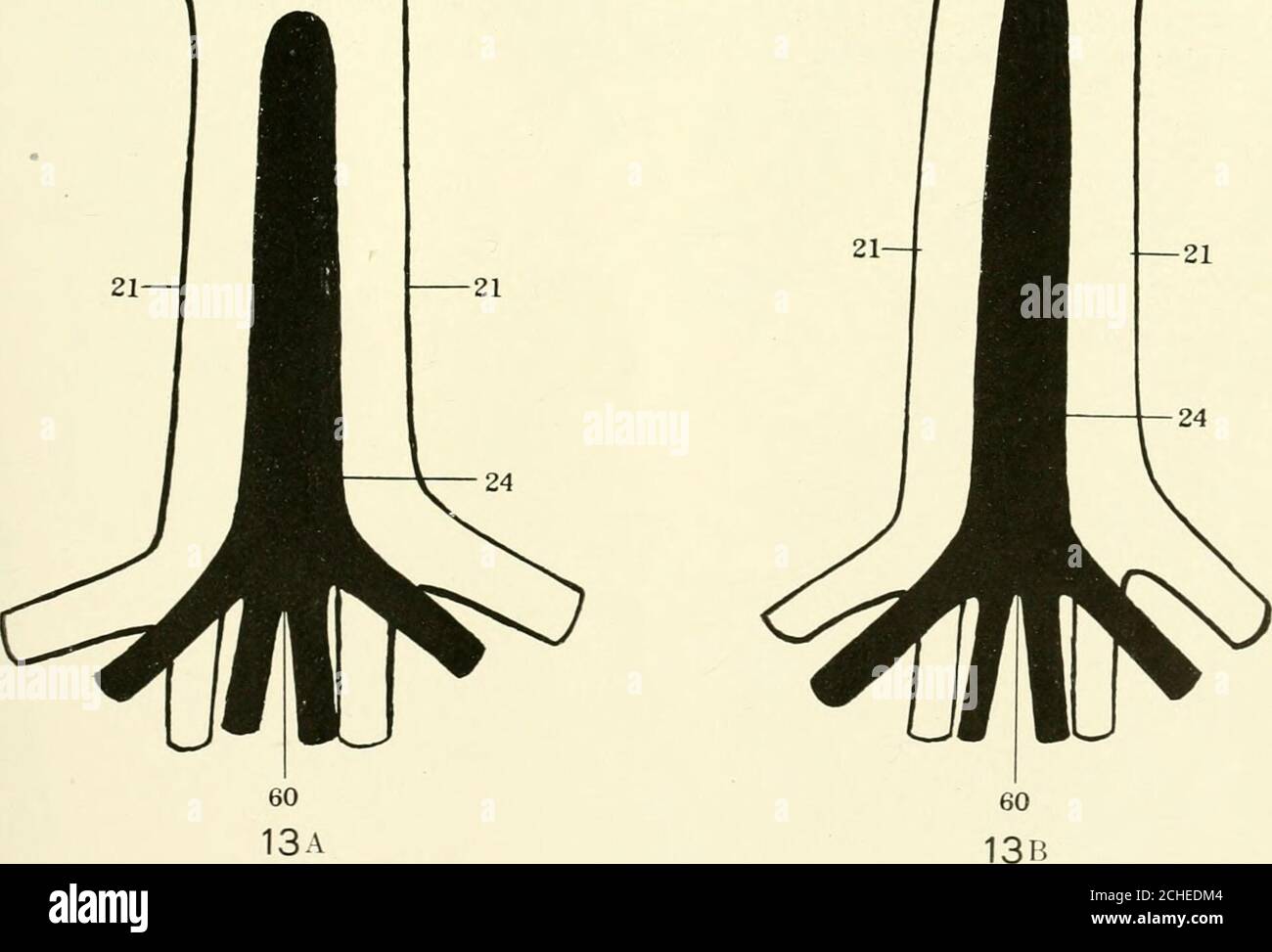 . La revue américaine de l'anatomie . 41-JBP JB» : 4i-g—j  Uamii 40 l  J—40 4°-( ^ 57 41. 245 PLANCHE 13 EXPLICATION DE LA FIGURE 14 coupe transversale montrant l'anastomose entre les veines cardinales de collateraland azygos dans un 23 mm. Embryon de Tragulus. Collection no 228. 21, veine cardinalcollatérale; 24, aorte; 28, segment azygos du canal thoracique; 51, veine azygosveine; 61, anastonose entre la collatérale cardinal et les veines azygos. 246 VEINES ET LYMPHOTIES DANS TRAGULUS FREDERICK TILNEY PLATE 13 Banque D'Images