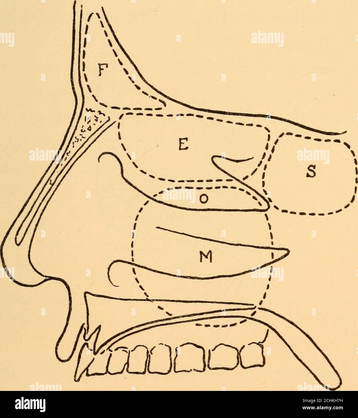 . Maladies du nez et de la gorge. Importance pratique, sont composés en grande partie d'erectiletissu, placés sur une fine plaque d'os et couverts de la membrane muqueuse. Le tissu érectile régule la largeur des méati respiratoires, ou les fentes entre les turbideset le septum. Les cavités nasales sont bordées de muqueuses, qui est recouverte d'un épithélium cilié columnaire, et qui contient des glandes séreuses et muqueuses. Les nerfs olfactifs descendent à travers la plaque cribriforme et sont distribués sur la surface du septum et la paroi externe aussi loin vers le bas que le milieu turbinate, de sorte que la supérieur Banque D'Images