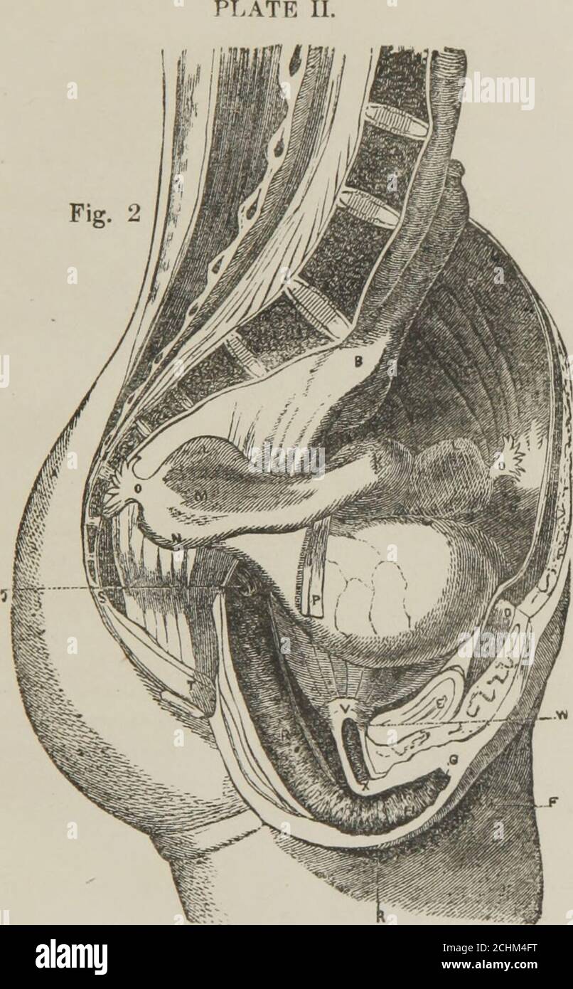 . Conseiller médical et guide du mariage : représentant toutes les maladies des organes génitaux de l'homme et de la femme. Les lettres d'argent ne doivent pas nous être envoyées à moins d'être enregistrées. PARTIE I. ATTENTION PARTICULIÈRE. Évitez tous les remèdes de cack ou annoncés pour toute maladie, espe-essentiellement vénérienne, et tous les instruments annoncés pour les émissions de cureSeminal, car ils sont des punaises de cack nuisibles. Au cours de la dernière année ou deux, il est apparu un certain nombre de médecins des champignons, prétendant être des hôpitaux dans les villes diferentes d'Europe, ou des étudiants d'hommes éminents, tels que Ricord, Acton, etc, en utilisant leur médicament Banque D'Images