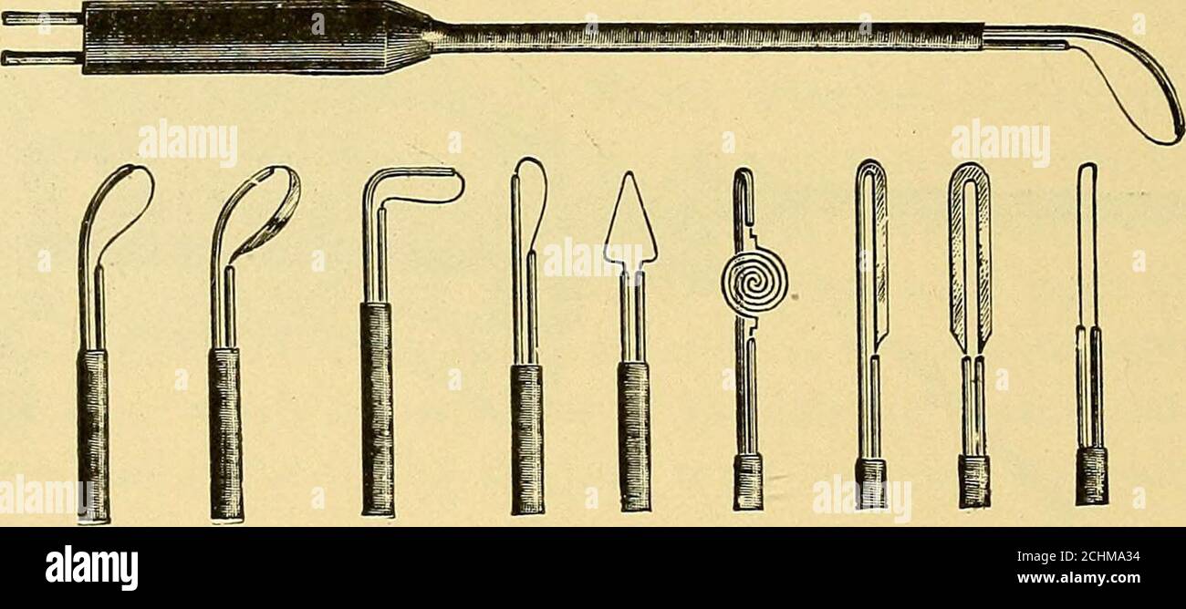 . Le traitement de la maladie par les courants électriques : un manuel d'instructions simples pour le médecin généraliste . e partie de l'extrémité postérieure du theptum et sont désagréables à l'extrême. Le traitement réussi par le mouvement est la destruction soigneuse de ce tissu hyper-trophique avec l'électro-cautérisation. Il est nécessaire de détruire l'ensemble du tissu, qui devrait être fait à l'eside à la fois.62 978 TRAITEMENT ÉLECTRIQUE DU NEZ. Avec un dépresseur de langue, le patient appuie sur sa langue, tandis que avec la main gauche, j'actionne le miroir de rhinoscopie (dans la gorge) et avec la main droite l'elec Banque D'Images