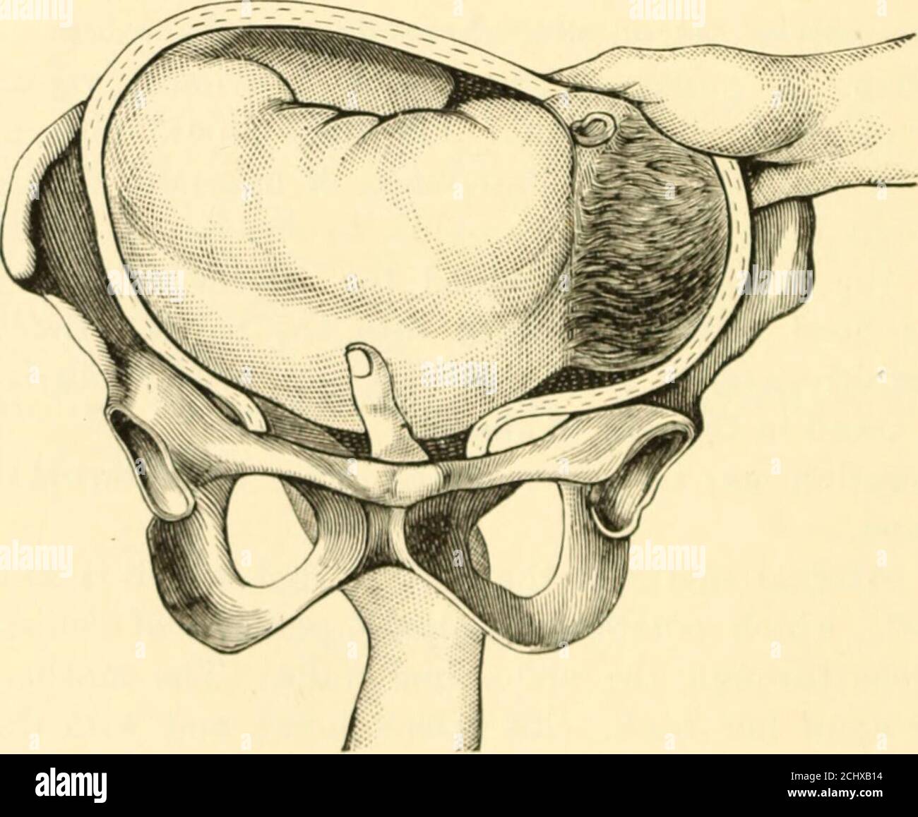 Position Cephalique Banque De Photographies Et D Images A Haute Resolution Alamy