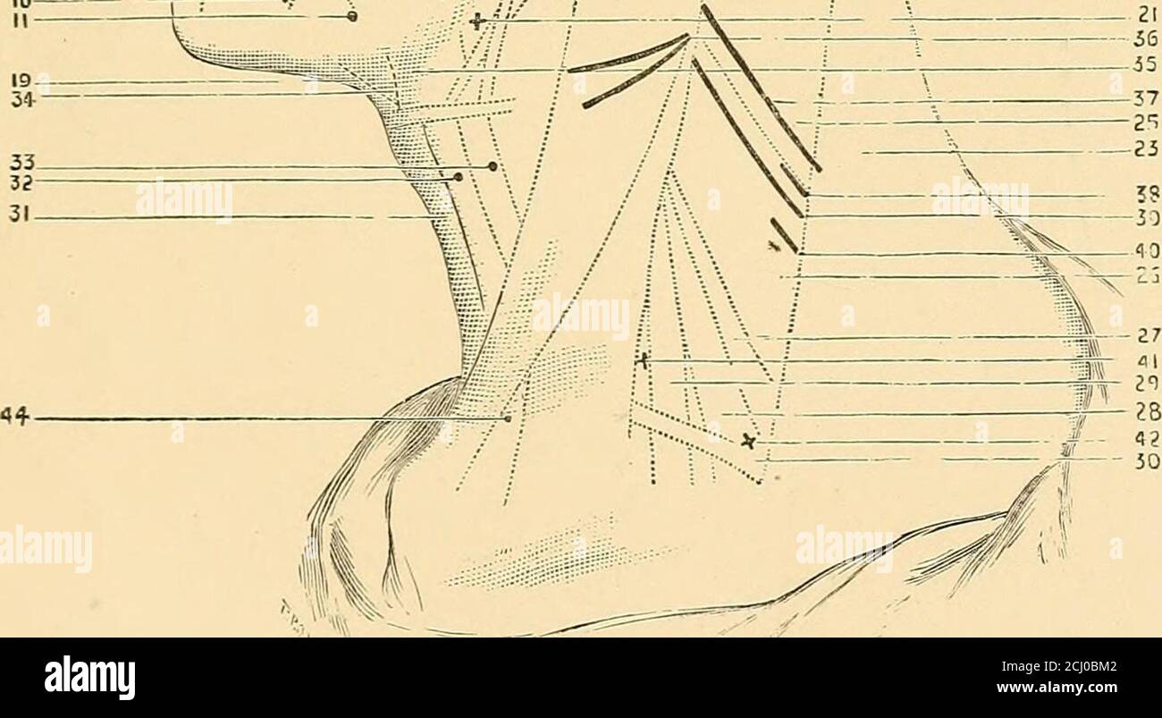 . Un traité pratique sur l'électrodiagnostic dans les maladies du système nerveux . DESCRIPTION DE LA PLAQUE II. Muscles superficiels et nerfs de l'Aspectateur antérieur OF le tronc et l'extbème supérieur. 1. Point moteur du muscle grand pectoralis. 2. Plexus brachial. 3. Pointe du moteur du muscle Magnus serratus. 4. Points moteurs du muscle oblique externe. 5. Point moteur du muscle latissimus Doi-si. 6. Point moteur du muscle abdominal oblique interne. 7. Points moteurs du muscle de Rectus abdominis. 8. Point moteur du muscle deltoïde. 9. Point moteur du muscle Biceps. 10. Points moteurs du muscle Brachialis Anticus. 11. T Banque D'Images