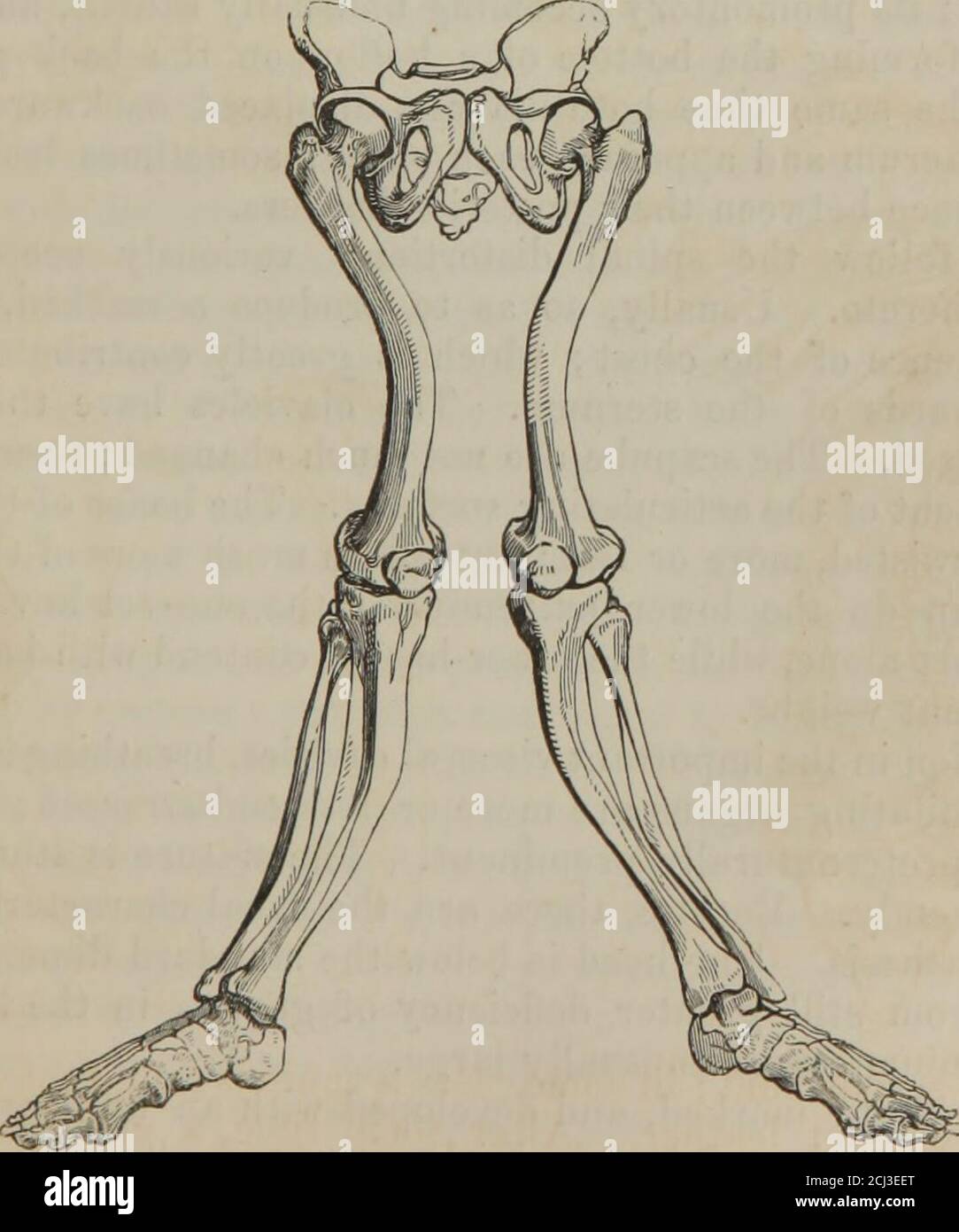 Les principes de la chirurgie . rin ou la gélatine de l'os. Et, outre cela,  l'arrêt comparatif de la croissance a lieu, en particulier dans les membres  inférieurs. Parfois, l'os entier