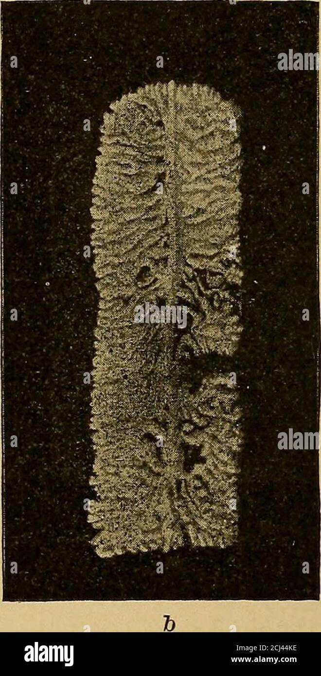 . Diagnostic physique . 183.—a, tête de Taenia saginata, beaucoup magnifié; ib, canal utérin de même.vingt branches de chaque côté. A propos de a réduit avec les masses irrégulières, sans forme qui habituellement appearin glisser et couvrir les préparations des fseces. Deuxièmement, la taille des oeufs parasitaires est plus grande que celle des mostof des objets vus dans les fèces; et, troisièmement, ils sont pour la mostpart brun foncé, souillée de bile (l'uncinaria est une exception). Les différences entre les espèces individuelles seront décrites plus tard. Dans les plaques II et III, les œufs les plus importants sont picturedés et catalogués. CABOT-PHY Banque D'Images