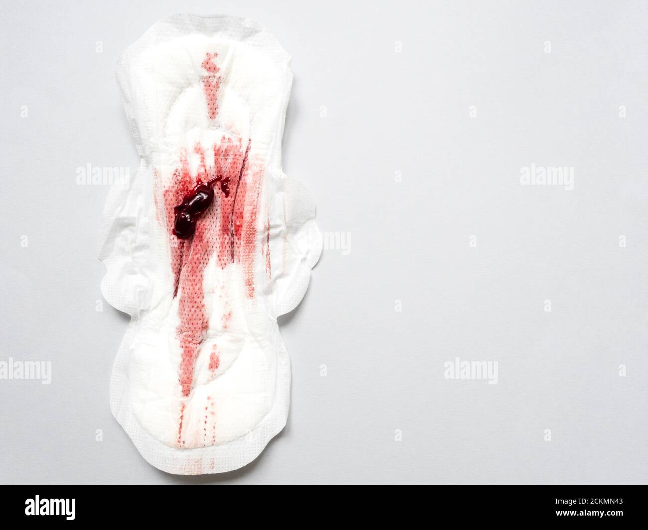 Symptôme d'endométriose, sang menstruel avec caillots de sang sur un tampon  sanitaire Photo Stock - Alamy