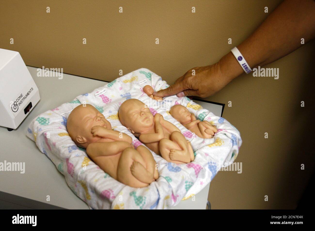 Foetus A 6 Semaines Banque De Photographies Et D Images A Haute Resolution Alamy