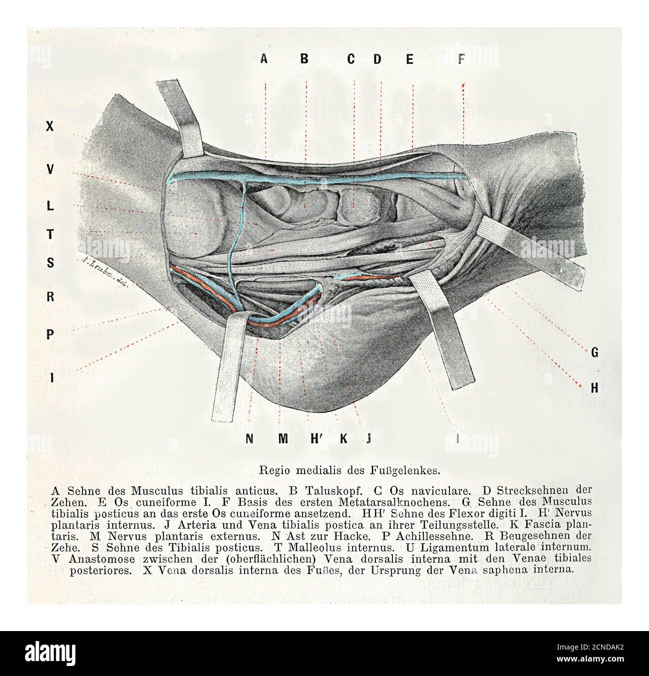Soins de santé et médecine : chirurgie de l'articulation du pied, illustration ancienne avec descriptions allemandes Banque D'Images
