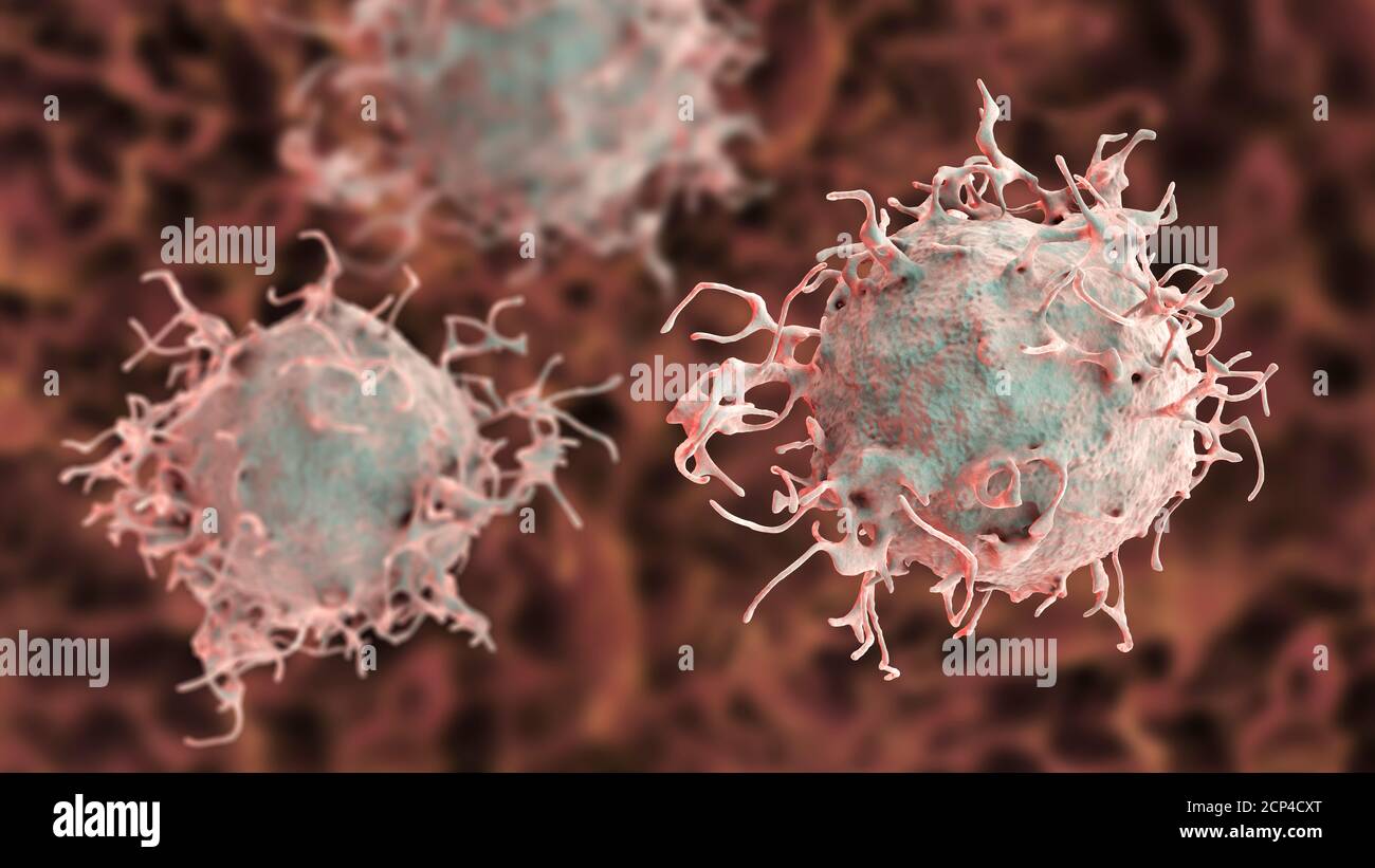 Cellule de cancer de la peau, illustration de l'ordinateur. Banque D'Images