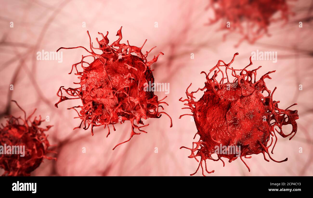 Cellule de cancer de la peau, illustration de l'ordinateur. Banque D'Images