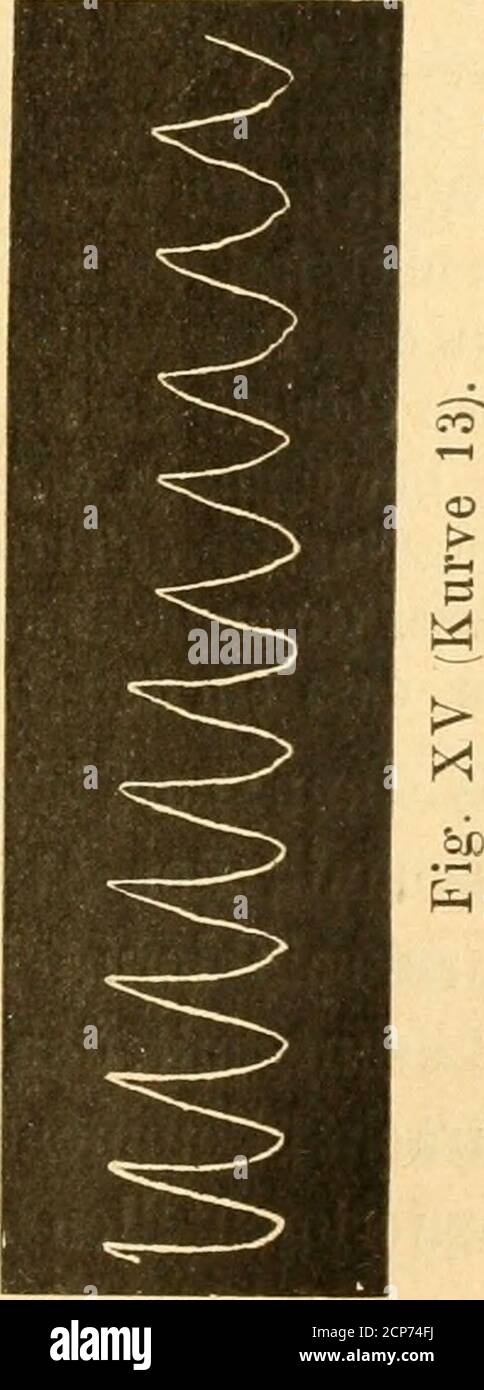 . Beiträge zur Kenntnis der Anatomie und physiologie der Athemwerkzeuge BEI den Vögeln . 68 sich schon konstante Diffusionsströnmngen zwischen den Luftsäckenund den Knochenhöhlen hervorrufen mUssen. Dass durch das Offnen hifthaltiger R,(3hrenknochen die Athmungnicht unbeträchtlich beeinflusst wird, wurde im vorigen Kapitel er-örtert. Diese Variationen der Athembewegung sind in Kurve 13 und 14dargestellt. Kurve 13. Bewegungen des Brustbeins eines Raben. Kurve 14. Die gleichen Bewegungen nach Öffnung beiderHumeri. Die Höhe der Kurve 13 verhält sich zu derjenigen derKurve 14 wie 1 : 2. y. Durchl Banque D'Images