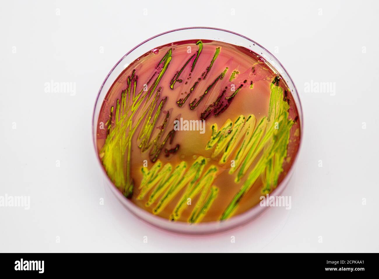 Des colonies caractéristiques d'Escherichia coli à feuilles vertes métalliques sur l'éosine bleu de méthylène AAR (EMB) sont en gros plan. Banque D'Images