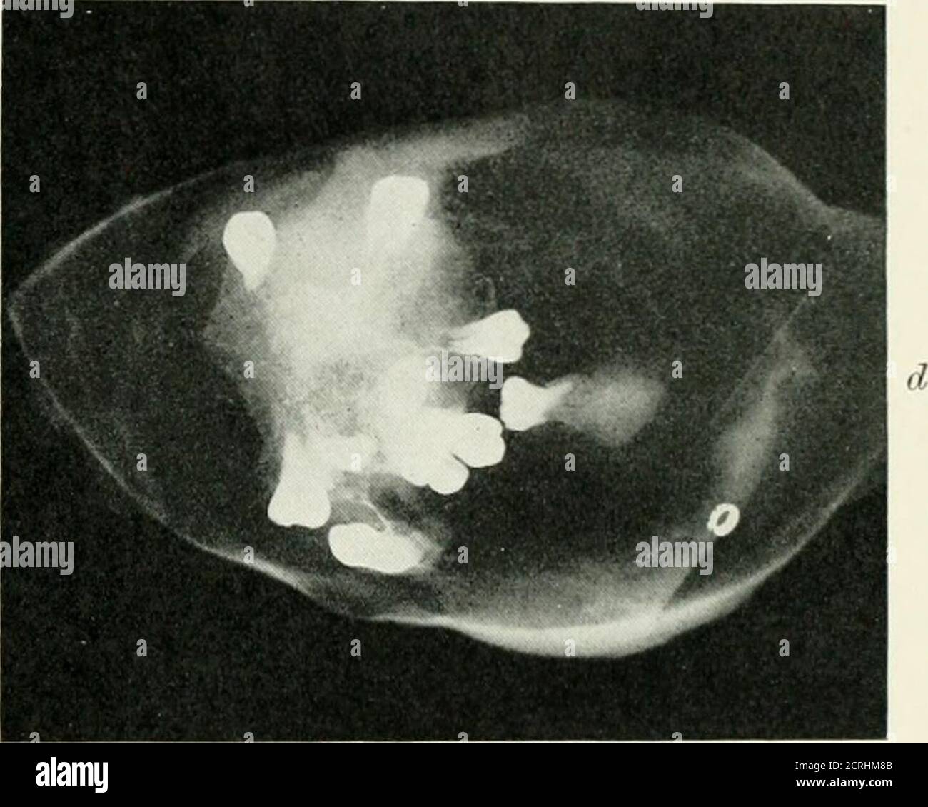 Men Extracting Radium Radiography x ray therapeutics radium therapy Banque de photographies ...