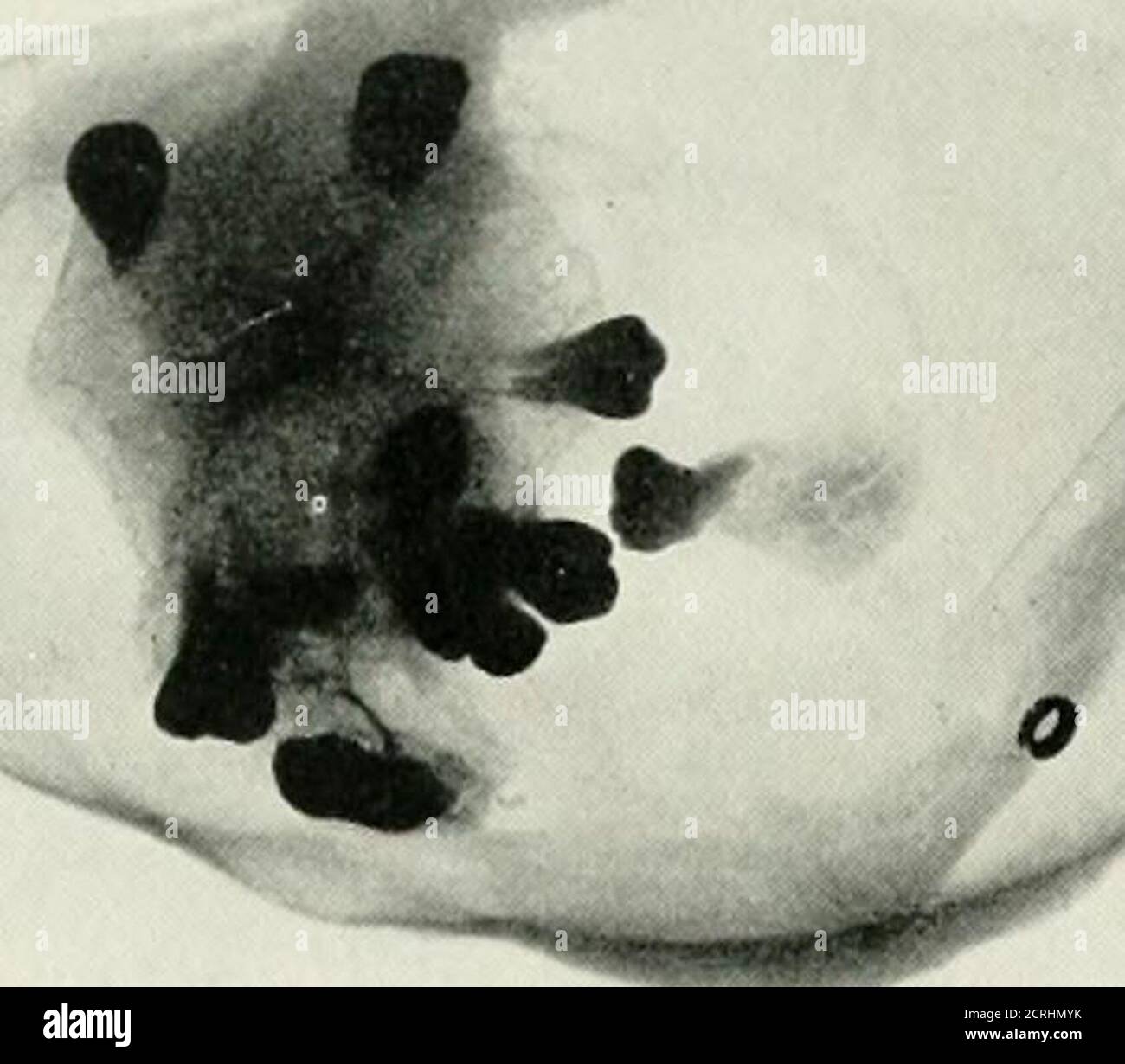 . Radiographie, traitements par rayons X et radiothérapie . Banque D'Images